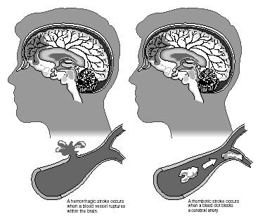 The human brain.  (Illustration by Hans & Cassady.)