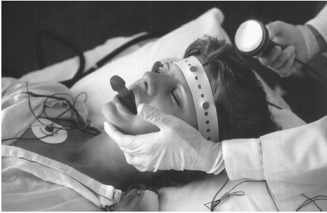 This woman has been prepared to receive electroconvulsive therapy— an effective treatment for depression. This patient has been given a short-acting medication that induces unconsciousness, and another medication was given that relaxes her muscles so that the induced seizures will not produce any violent contractions. Instead, the patient lies quietly on the operating table. The rubber mouthpiece keeps her from biting down on teeth or her tongue during the seizure. (Photo Reasearchers, Inc. Reproduced by permission.)