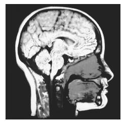 MRI scan of human brain. (Scott Camazine and Sue Trainor. Photo Researchers, Inc. Reproduced by permission.) See color insert for color version of photo.